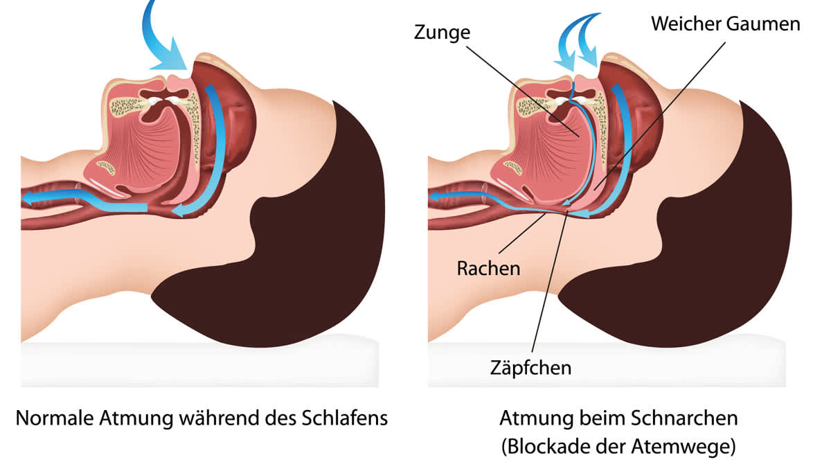 Weicher Gaumen