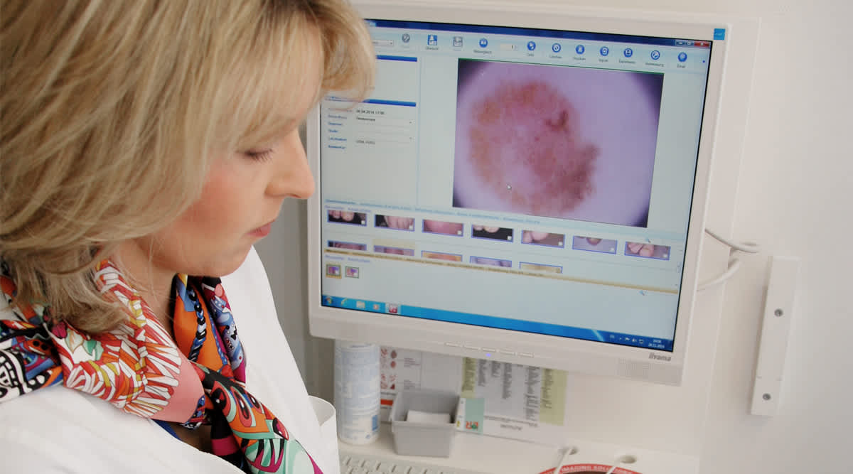 Dr. Feller-Heppt und ihr Team setzen zur Hautkrebsvorsorge moderne Diagnosegeräte ein