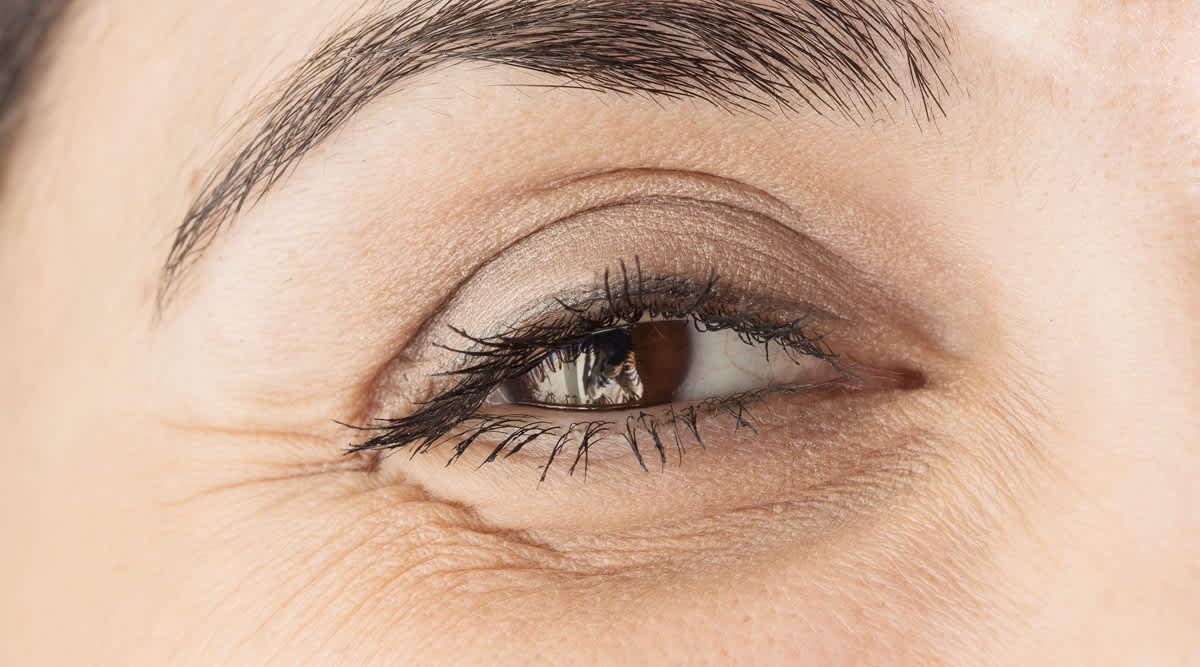 Schönere Augen durch Filler